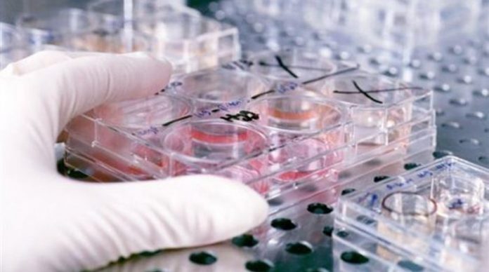 Ρωσία: Λιστέρια σε εισαγόμενα πουλερικά και κρέατα από Βραζιλία και Αργεντινή Ρωσία: Λιστέρια σε εισαγόμενα πουλερικά και κρέατα από Βραζιλία και Αργεντινή