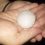 Καστοριά: Χαλάζι σε μέγεθος αυγού -Ζημιές σε καλλιέργειες και οχήματα